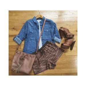 Zig Zag-Patterned Shorts